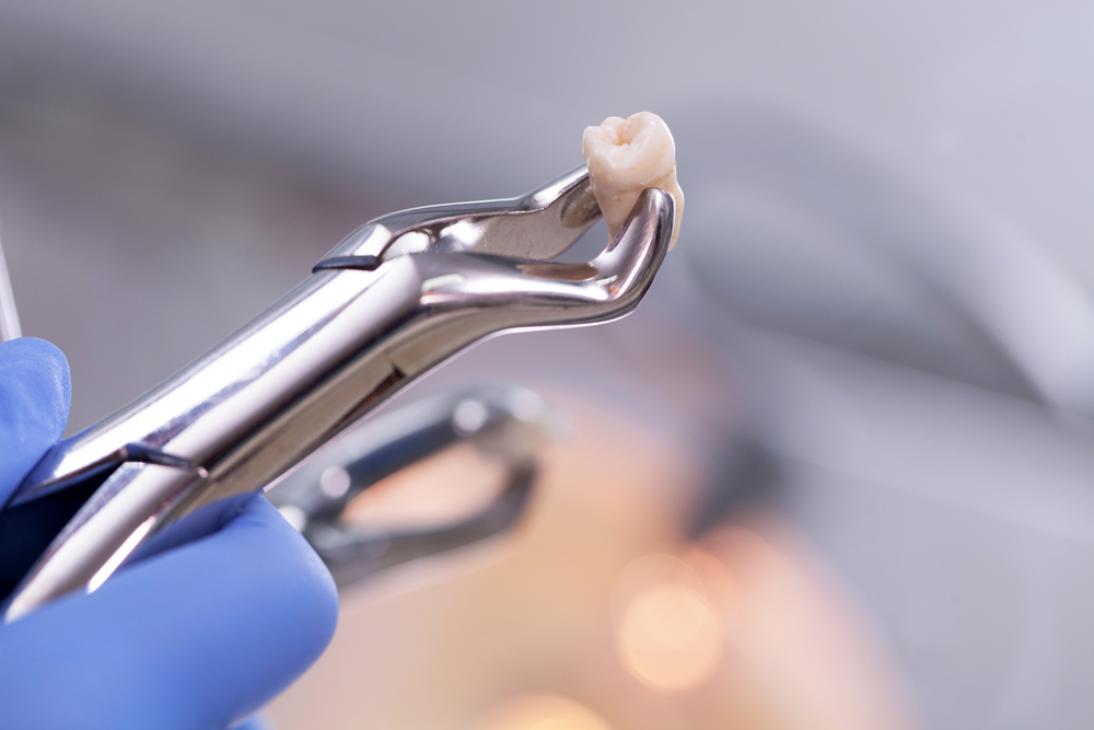 Pliers holding a tooth