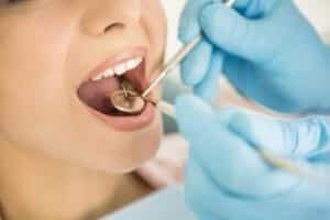 Dentist Examining Teeth