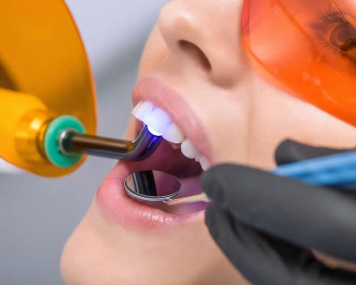 Woman Undergoing Laser Dentistry — Advanced Dental Southern Highlands In Moss Vale, NSW