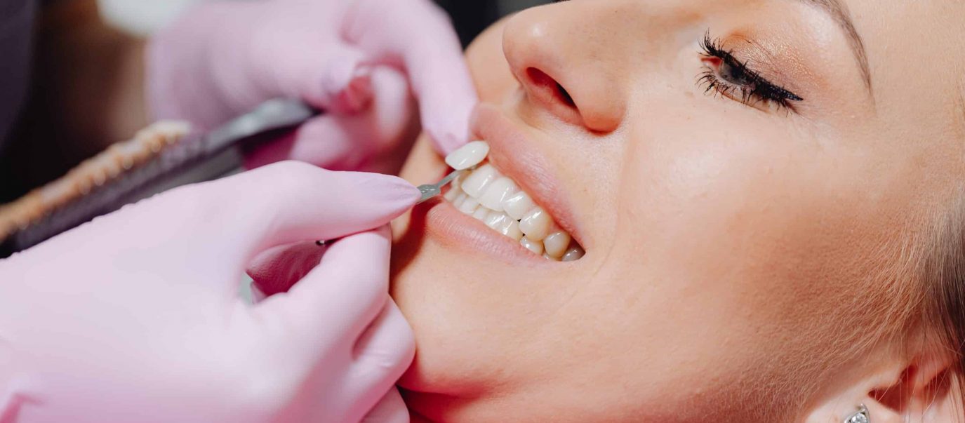 Woman Getting Teeth Whiting Done — Advanced Dental Southern Highlands In Moss Vale, NSW